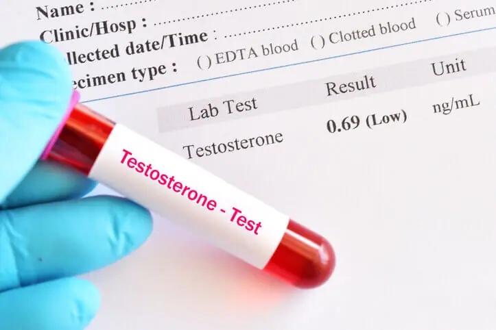 Medical professional holding a blood sample vial over a lab report showing a low testosterone level of 0.69 ng/mL.