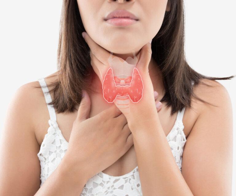 A woman in a white dress holding her hand to her throat with a red butterfly-shaped thyroid gland anatomical overlay highlighted.