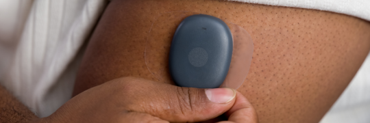 A close-up of a person applying a dark grey circular Continuous Glucose Monitor (CGM) sensor to the back of their upper arm.